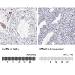 SMIM2 Antibody, Novus Biologicals 25 &mu;L; Unlabeled:Antibodies, Polyclonal